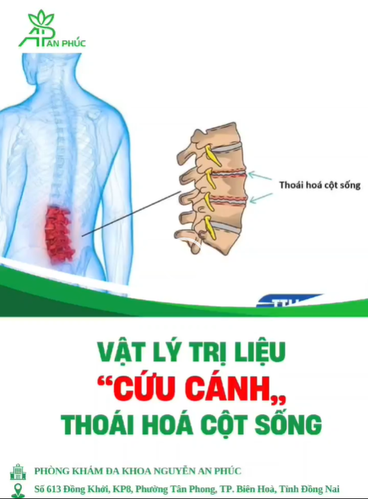 VẬT LÝ TRỊ LIỆU CỨU CÁNH CỦA THÁI HÓA CỘT SỐNG